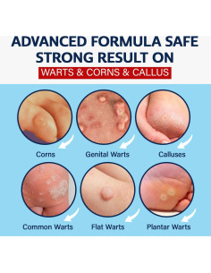 Removedor de Verrugas MEOLY 30 ML - Acción Rápida Ácido Salicílico 2