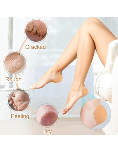 30 Parches Adhesivos TEAWOO para Talones Agrietados 80mm 2