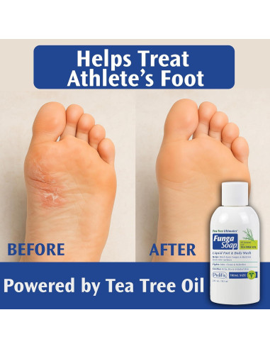 FungaSoap PediFix Jabón Antifúngico 59 ml - Aceite de Árbol de Té