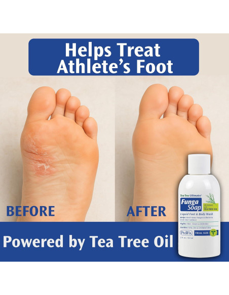 FungaSoap PediFix Jabón Antifúngico 59 ml - Aceite de Árbol de Té
