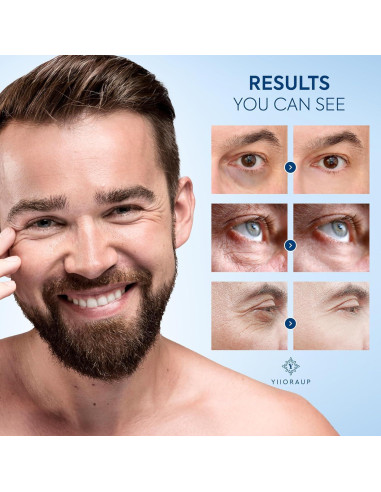 Crema para Ojos con Cafeína para Hombres - Rodillo Desinflamador