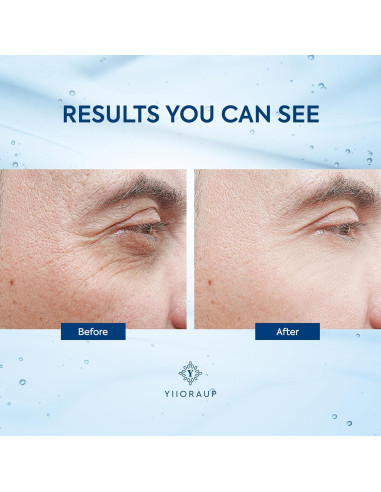 Crema para Ojos con Cafeína para Hombres - Rodillo Desinflamador