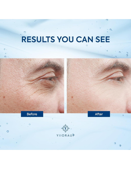 Crema para Ojos con Cafeína para Hombres - Rodillo Desinflamador