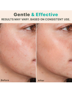 Rodillo Derma Beauty by Earth 0.25mm para Piel y Barba 2