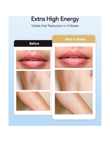 Depilador IPL INNZA Oro Rosa 999,999 destellos Indoloro