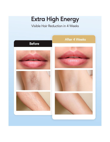 Depilador IPL INNZA Oro Rosa 999,999 destellos Indoloro