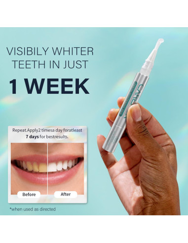 Kit Blanqueamiento Dental 7 Días Onuge - 14 Tiras + Lápiz