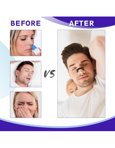 Tiras Nasales Antironquidos Shenzhen Ai li Wei 60 Ct