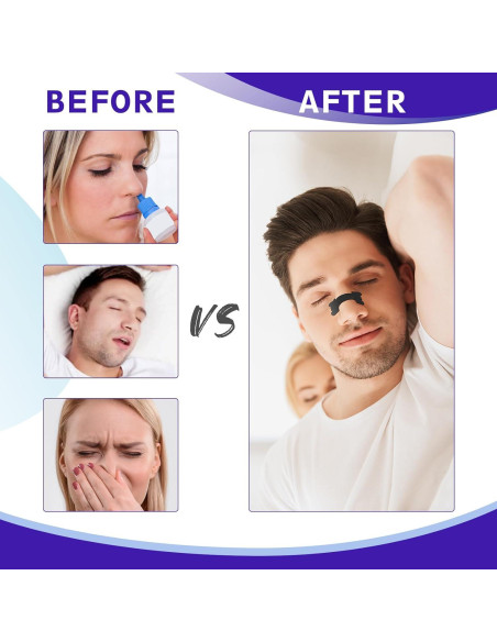 Tiras Nasales Antironquidos Shenzhen Ai li Wei 60 Ct