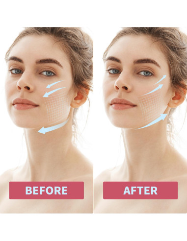 Cinta Facial V InfiniteRelax para Elevación y Mandíbula