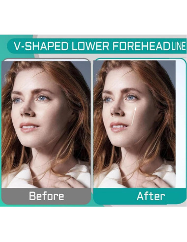 Ejercitador de Mandíbula Sushenwe 6 Pcs Silicona 3 Niveles