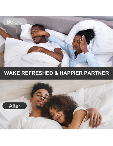 Tiras Nasales MQ para Ronquidos - Fuerza Extra, 100 Unidades