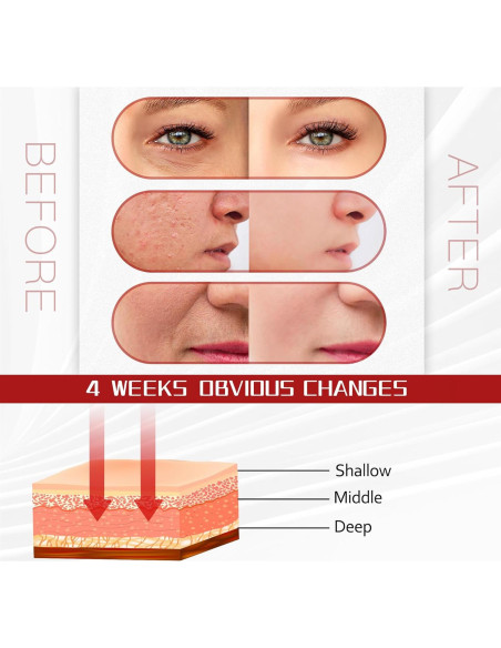 Máscara de Luz LED Facial SJFEHLLD 7 Colores Terapia