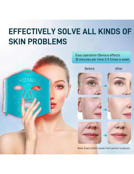 Máscara Facial LED Weetall 276 LEDs Terapia Luz Roja