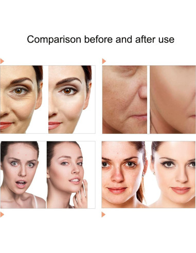 Máscara Facial LED 7 Colores Caweiya para Cuidado de la Piel