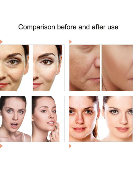 Máscara Facial LED 7 Colores Caweiya para Cuidado de la Piel