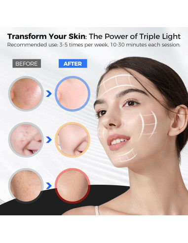 Máscara de Luz LED Aolady para Cara - Terapia Antienvejecimiento