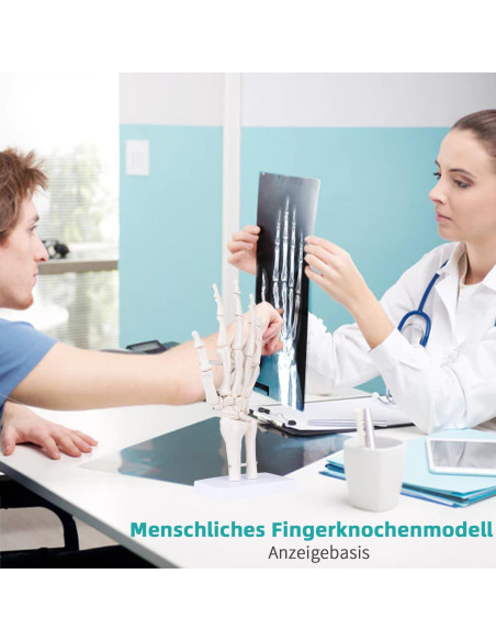 Modelo de Mano Esquelética Humana LVCHEN 25cm Articulada