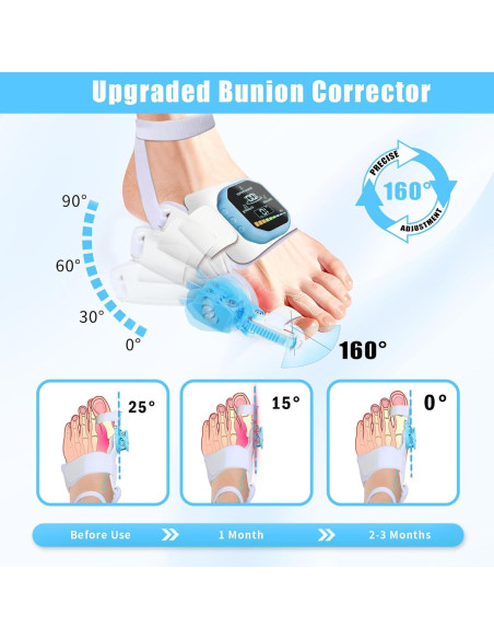 Corrector de Juanetes ATEGESE con Masajista y Estimulador