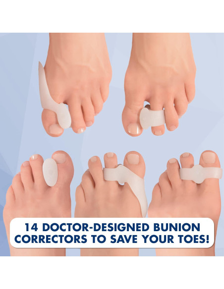 Kit Corrector de Juanetes Dr. Frederick 14 Piezas Alivio Rápido