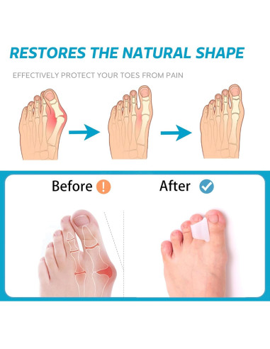 Corrector de Dedo en Martillo Nolimvita - Paquete de 6 Pequeño