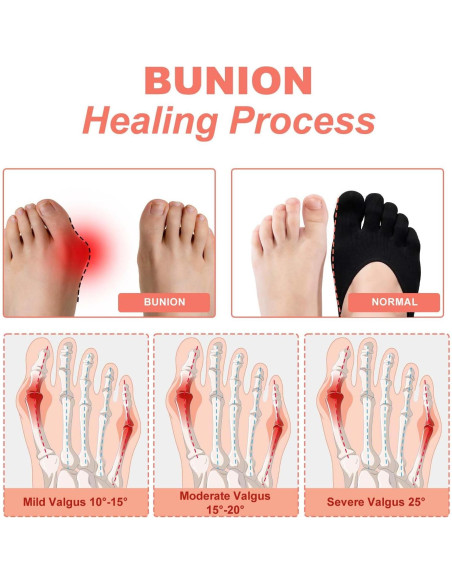 4 Pares Calcetines Compresión Ortopédica Mujeres Talla 6-9