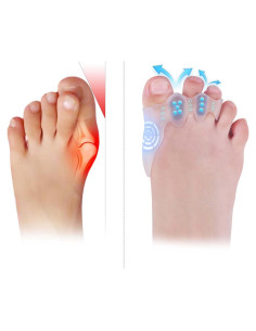 Separadores de Dedos TEVEZO para Niños - Corrector de Juanetes