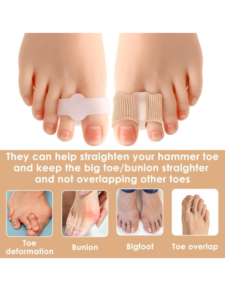 Separadores de Dedos de Gel Ptwola 4 Piezas Correctores Juanetes