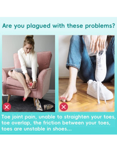 Corrector de Dedo en Garra Byehambuni, 6 Piezas Pequeñas Beige 2