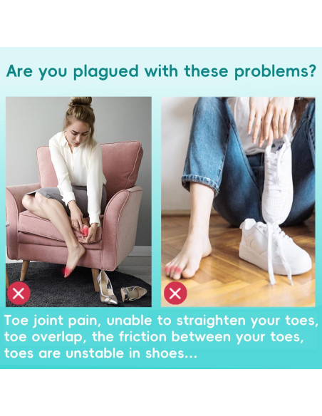 Corrector de Dedo en Garra Byehambuni, 6 Piezas Pequeñas Beige