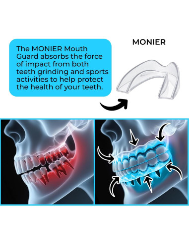 Protector Bucal Nocturno MONIER para Rechinar Dientes - 4 Unidades