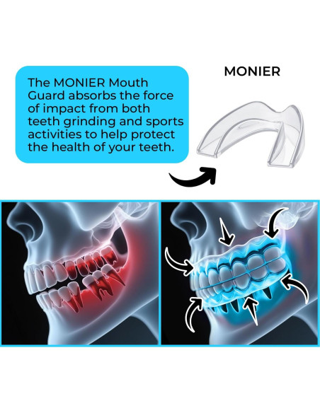 Protector Bucal Nocturno MONIER para Rechinar Dientes - 4 Unidades