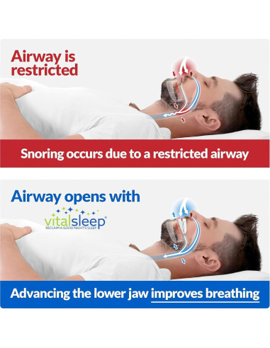 VitalSleep Dispositivo Anti-Ronquidos Ajustable - Set de 2