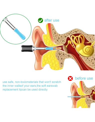 100 Piezas Consejos de Silicona para Limpiar Oídos Angelise