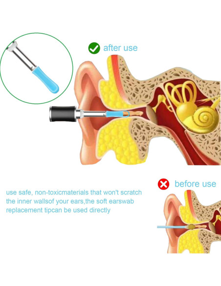 100 Piezas Consejos de Silicona para Limpiar Oídos Angelise