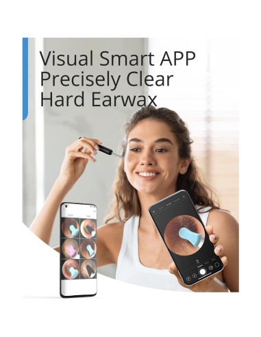 BEBIRD R1 Limpiador de Cerumen con Cámara HD y Luz LED