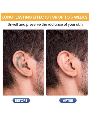 Kit de Cera para Oídos y Nariz SUERBEATY 100g Indoloro