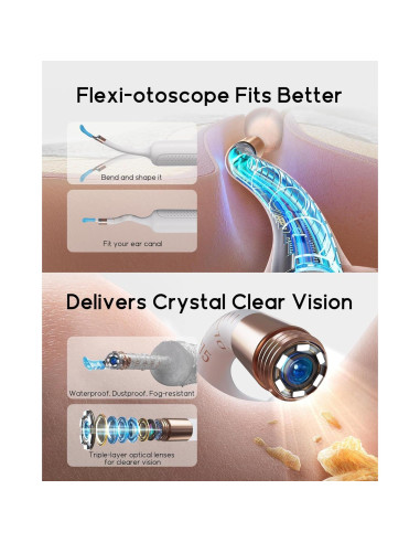 Bebird Earsight Plus R37R Kit Limpieza Oídos Cámara HD