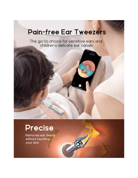 Bebird Earsight Plus R37R Kit Limpieza Oídos Cámara HD