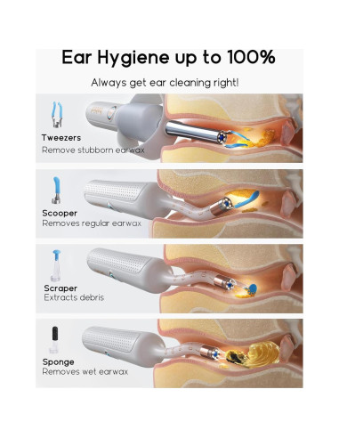 Bebird Earsight Plus R37R Kit Limpieza Oídos Cámara HD