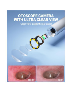 Otoscopio digital ScopeAround con pantalla IPS 11,43 cm FHD 2