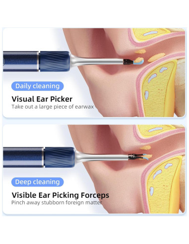 Cámara de oído Qimic S8 HD 1080P con pinzas y luz