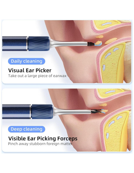 Cámara de oído Qimic S8 HD 1080P con pinzas y luz