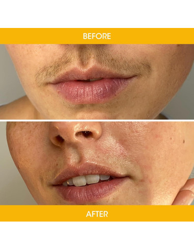 Cintas de Cera Facial Nad's - Natural 30 Cuentas