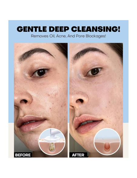 Limpiador Facial Espumoso Srripo 248g Piel Sensible Azul