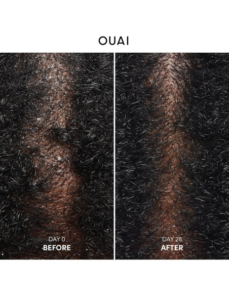 Champú Anticaspa OUAI 300 ml - Suave con Ácido Salicílico