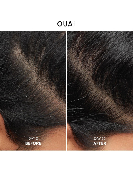 Champú Anticaspa OUAI 300 ml - Suave con Ácido Salicílico