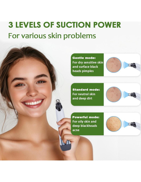 Aspiradora de Puntos Negros Xamoca USB 3 Niveles 4 Probes