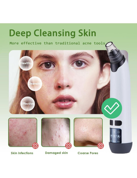 Aspiradora de Puntos Negros Xamoca USB 3 Niveles 4 Probes