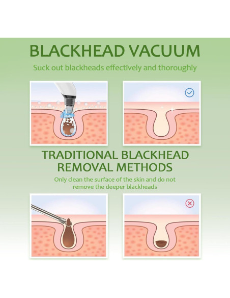 Aspiradora de Puntos Negros Xamoca USB 3 Niveles 4 Probes